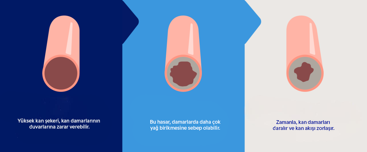 Diyabet, İnme ve Kardiyovasküler Hastalıklar